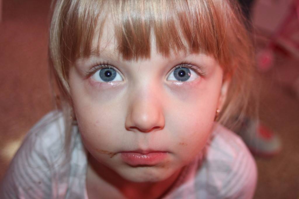 Почему у ребенка синеет переносица - медсостав