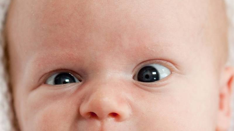 Новорожденный косит глазами - симптомы, профилактика, лечение, причины