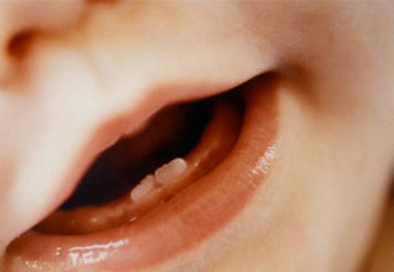 Какое обезболивающее выбрать при прорезывании зубов?