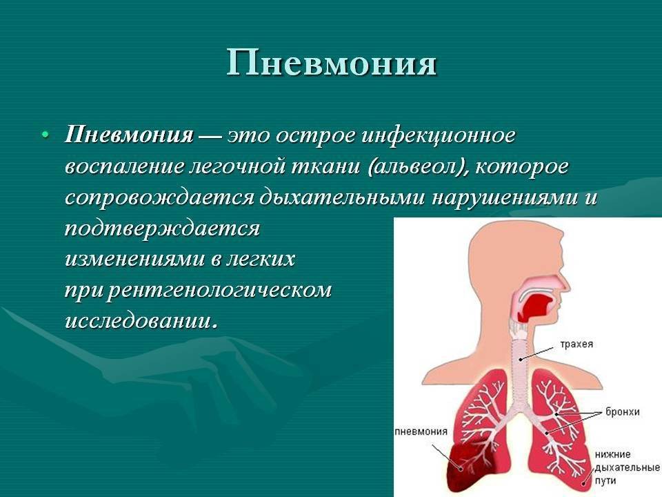 Пневмония у грудничка. отличительные особенности воспаления легких у младенцев и детей старшего возраста
