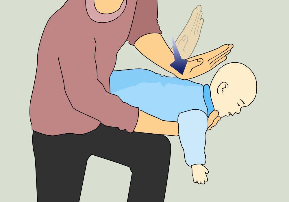 Что делать если младенец подавился