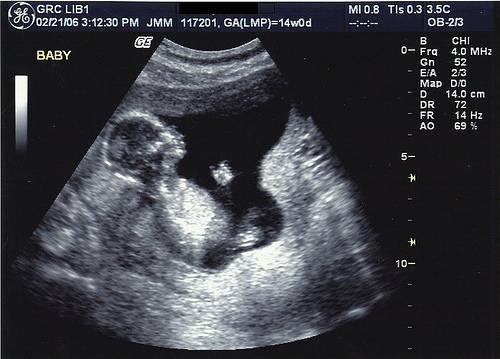 14 неделя беременности: развитие плода, что происходит с малышом и мамой, ощущения в животе — медицинский женский центр в москве