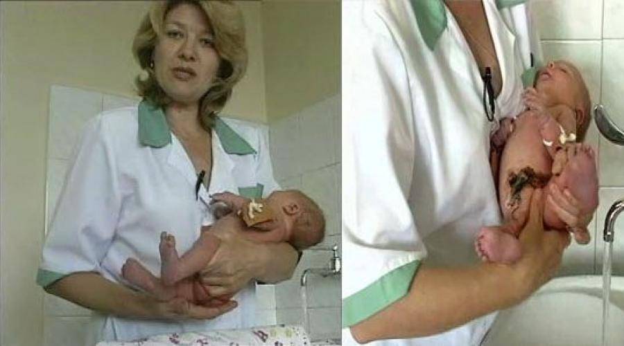 Гигиена новорожденной девочки: особенности ухода, как удалить смегму, предотвращение синехий
