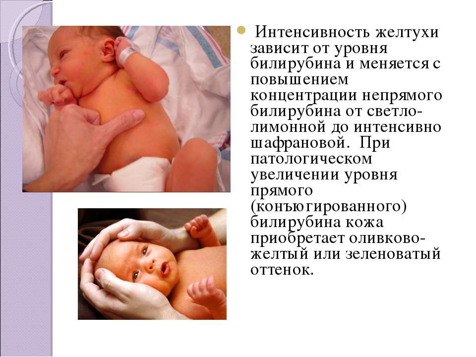Желтуха у новорожденного – о причинах, опасностях и методах лечения рассказывает  неонатолог клиники isida — клиника isida киев, украина