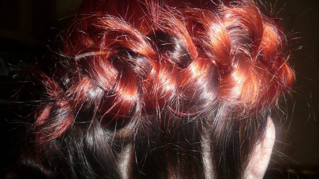 Выпадение волос у молодых мужчин: причины, лечение, профилактика