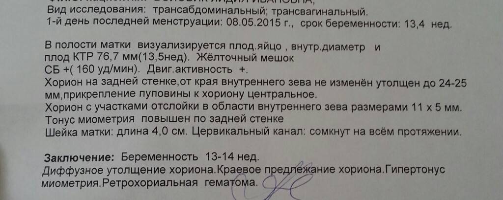 Угроза прерывания беременности