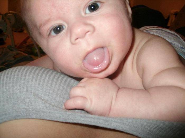 У ребенка постоянно открыт рот что делать. почему грудной ребенок постоянно жует и высовывает язык: патологические причины или способ общения новорожденного