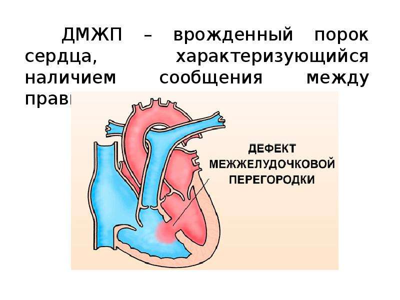 Аномалии развития зубов: причины, симптомы и лечение