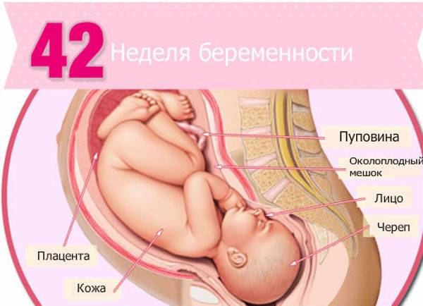 42 неделя беременности - никаких признаков родов. что делать?