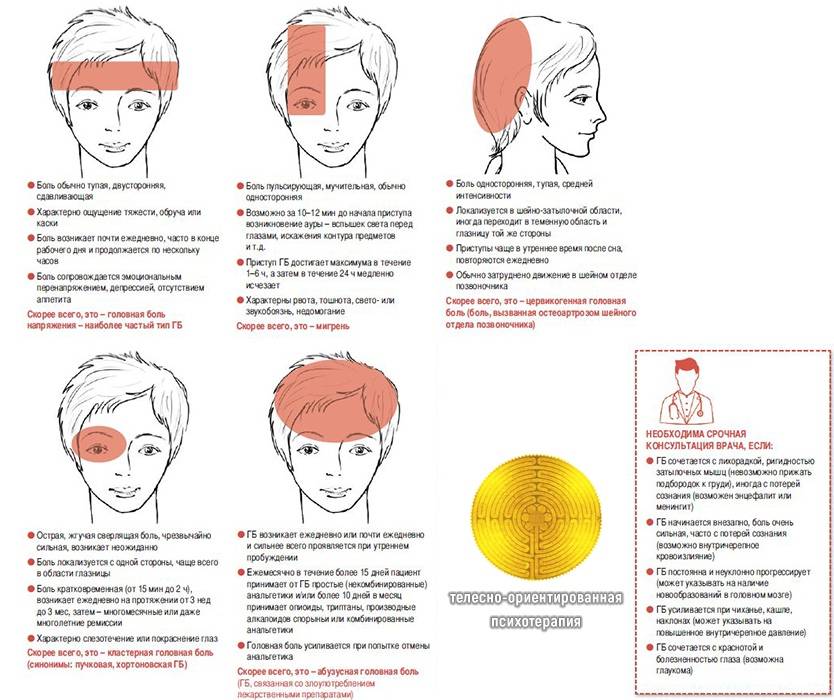 Головная боль на картинке виды