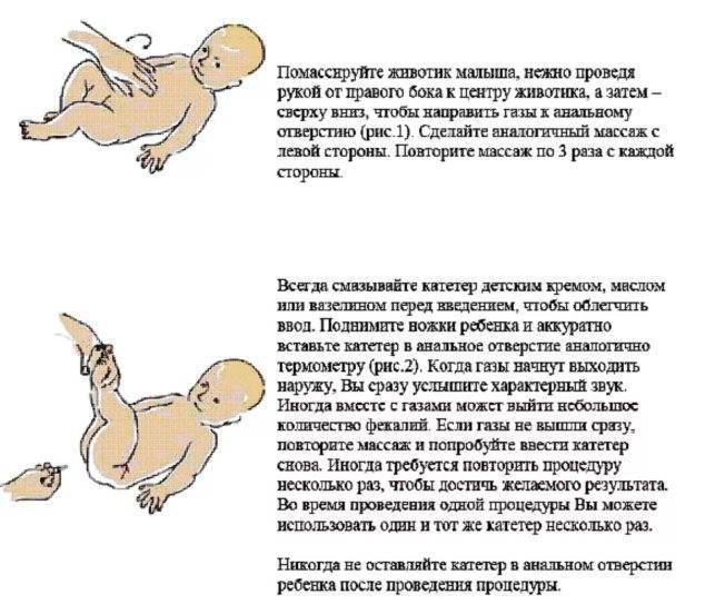 Ставим газоотводную трубочку новорожденному, как пользоваться ею при газах