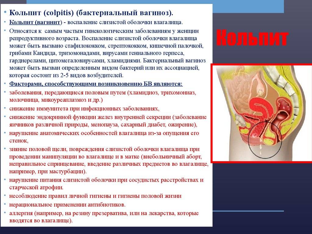 Старческий кольпит: вагинит/кольпит у пожилых | лечение воспаления влагалища в спб (санкт-петербург, неомед) | (812) 249-0-249