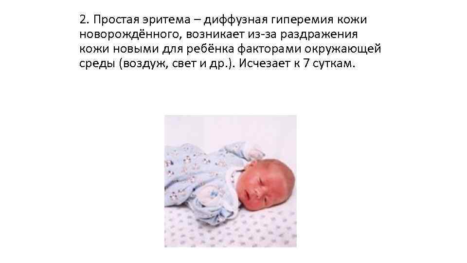Пограничные состояния новорожденных: краткое описание