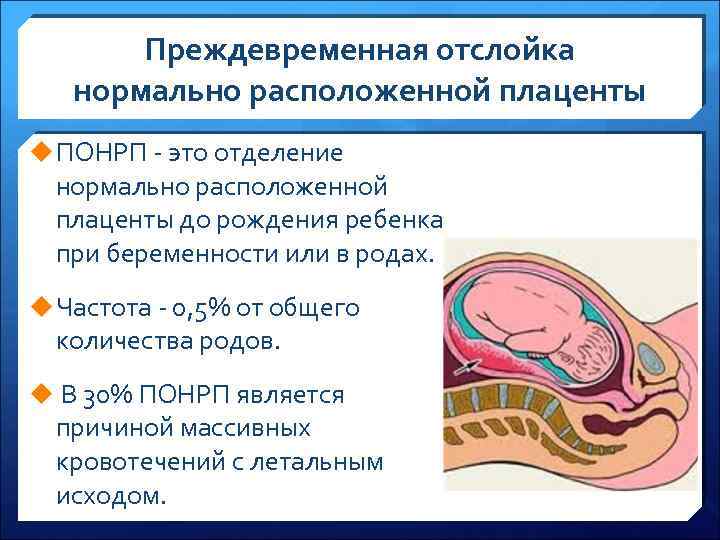 Презентация отслойка плаценты