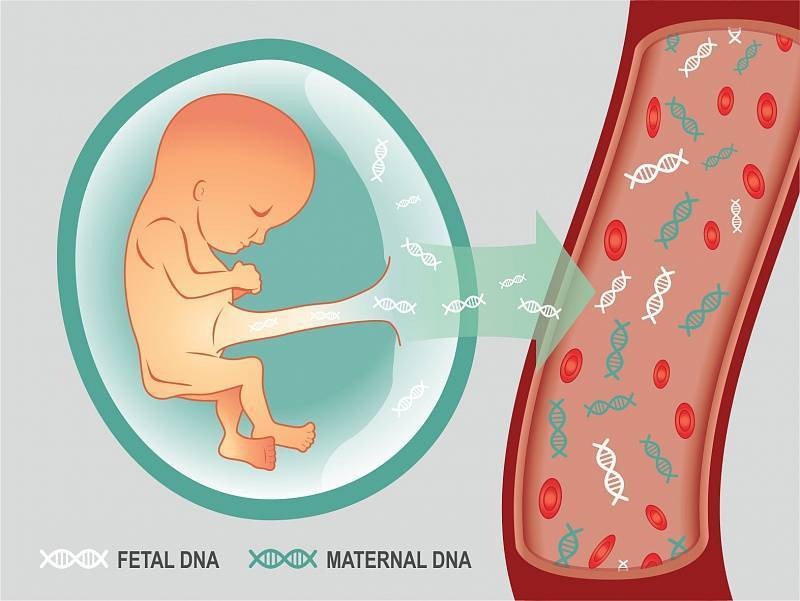Неинвазивный пренатальный тест – нипт (20 фото): что это такое, анализ днк плода при беременности – отзывы
