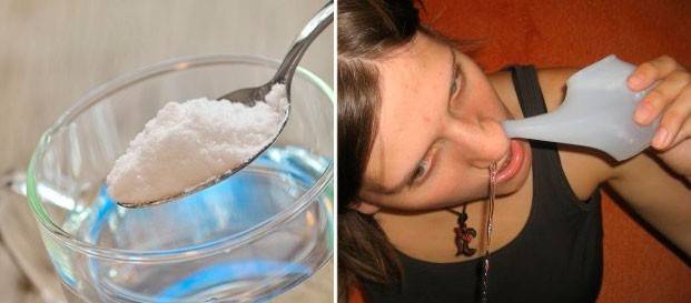 Солевой раствор для промывания носа ребёнку: приготовление, использование pulmono.ru
солевой раствор для промывания носа ребёнку: приготовление, использование