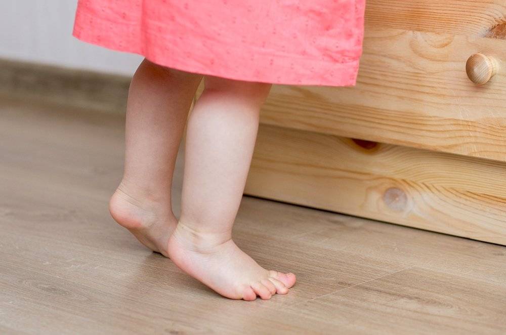 Ребенок ходит на носочках (на цыпочках): причины, что делать родителям