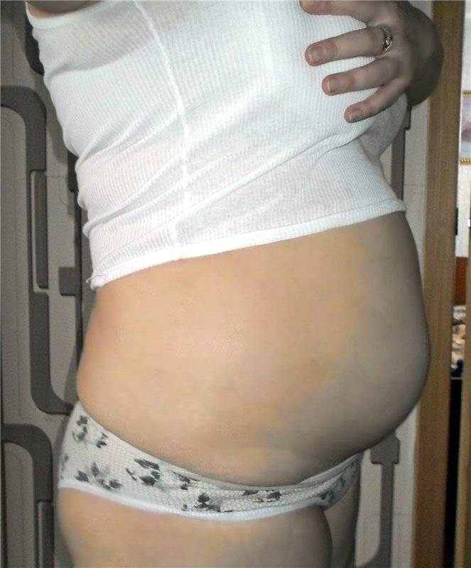 18 неделя беременности – что происходит, ощущения в животе на восемнадцатой неделе беременности, узи и развитие плода - agulife.ru