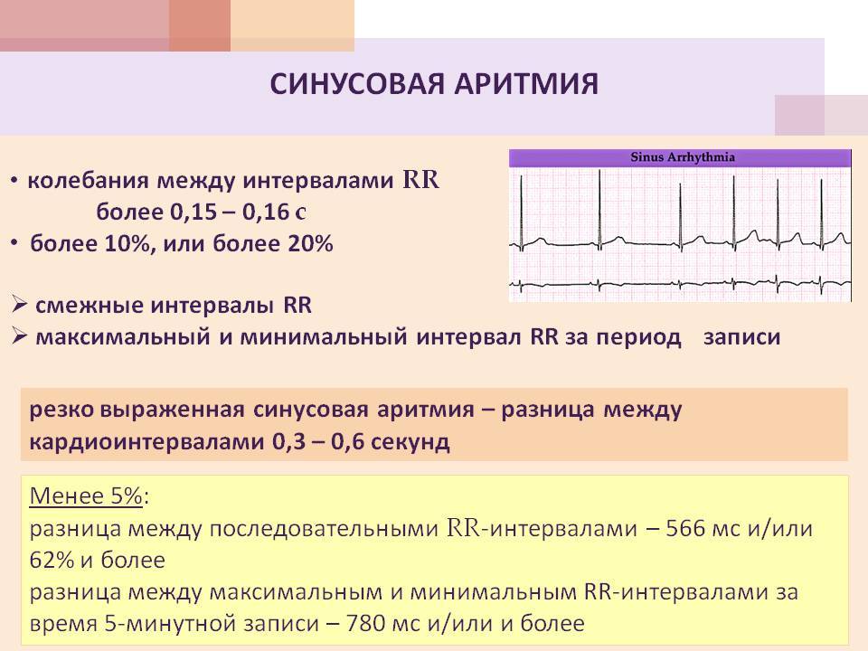 Сердечная недостаточность