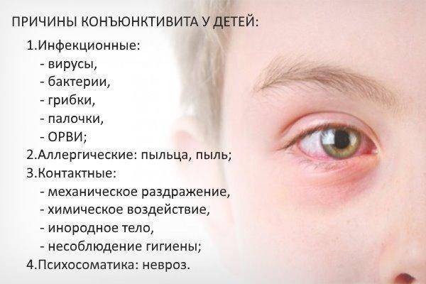 Лечение конъюнктивита у детей народными средствами - энциклопедия ochkov.net