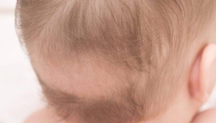 Выпадают волосы у грудничка: причины и их устранение