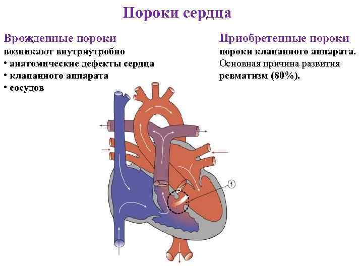 Врожденные пороки сердца: виды и методы диагностики