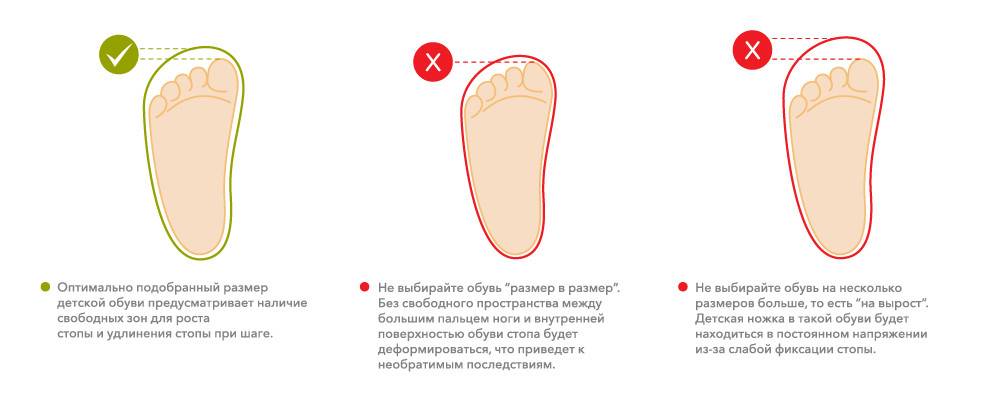  важно знать, как выбрать размер зимней обуви ребенку