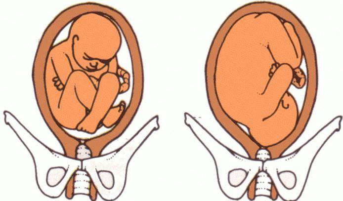 На каком сроке беременности ребенок переворачивается вниз головой и принимает окончательное положение в матке?