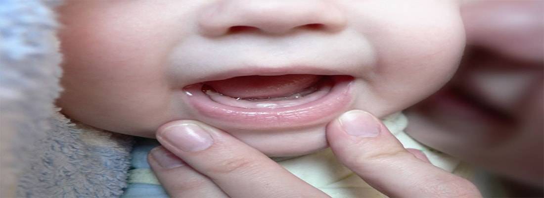 Какие первые зубы лезут у грудничка