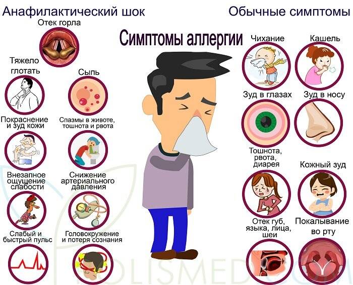 Поллиноз - симптомы, причины, профилактика и лечение