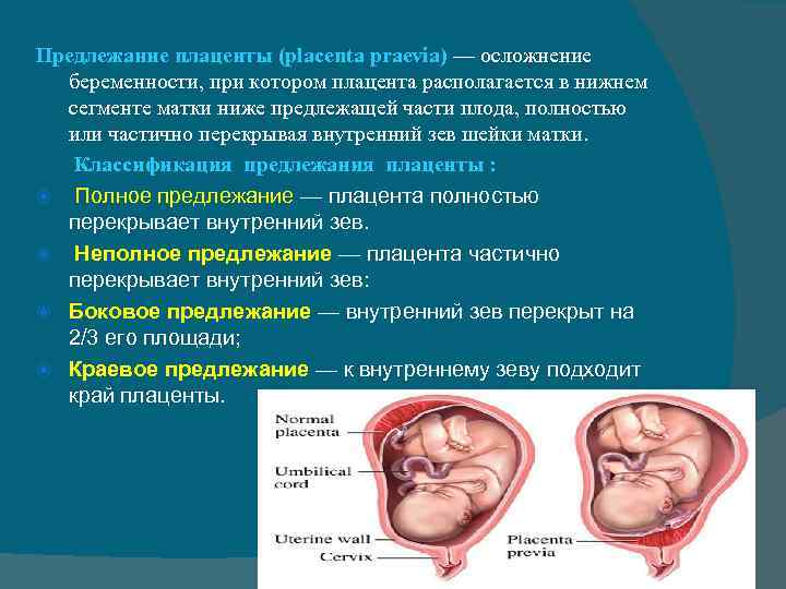 Что значит низкая плацентация при беременности? чем опасна низкая плацентация?