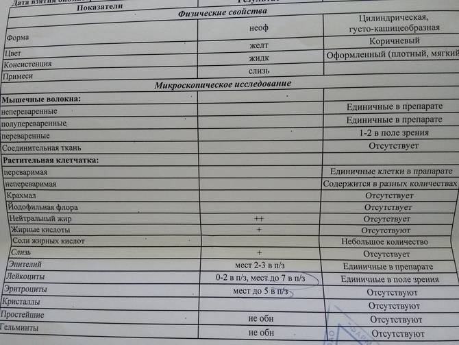 Анализ кала: результаты анализа копрограммы