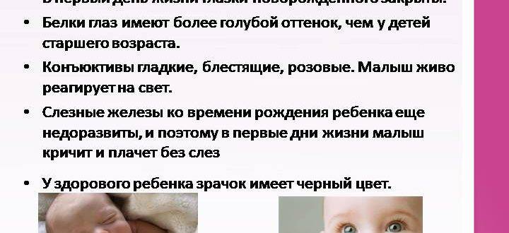 Как вылечить косоглазие в домашних условиях у ребенка - энциклопедия ochkov.net