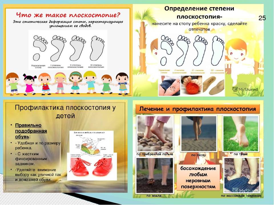 Профилактика плоскостопия у детей - способы профилактики детского плоскостопия - блог стельки.ру