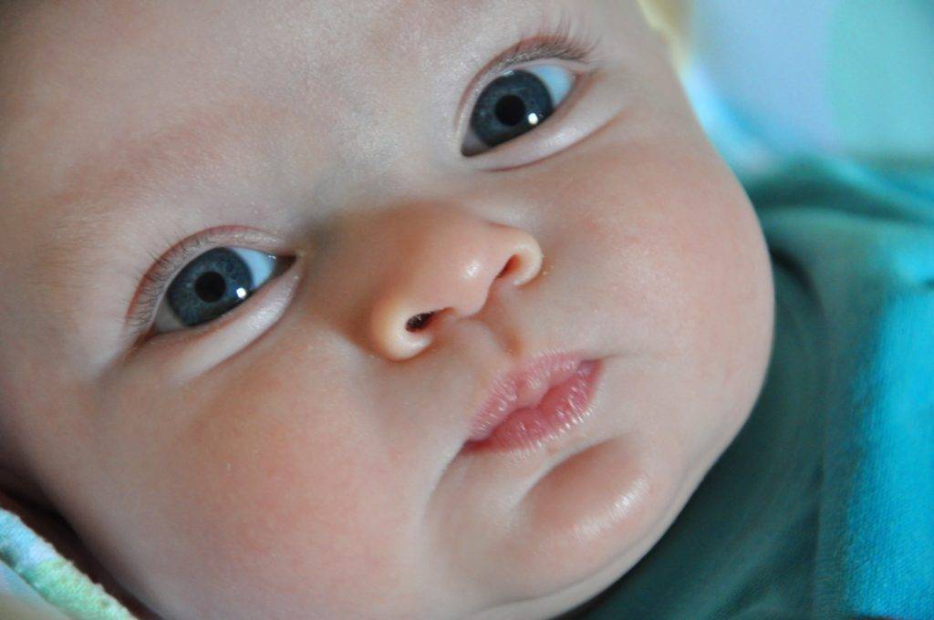 Отек глаз у ребенка после сна: причины, методы лечения и профилактика - sammedic.ru