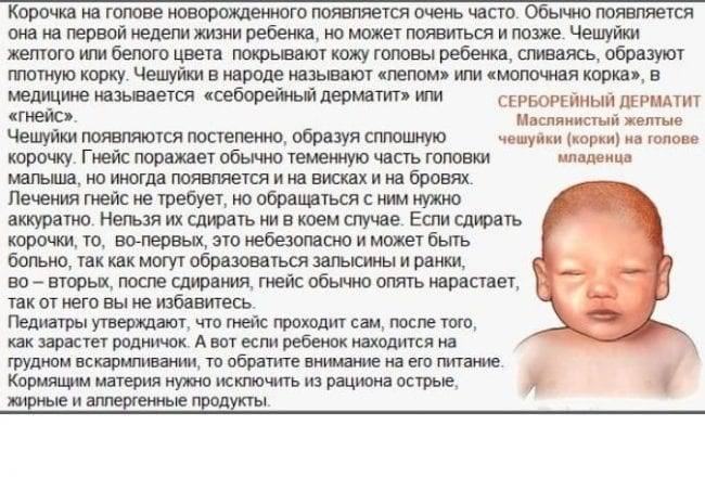 Конъюнктивит и насморк у ребенка: причины и лечение - энциклопедия ochkov.net