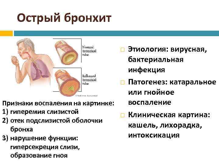 Бронхит у детей презентация