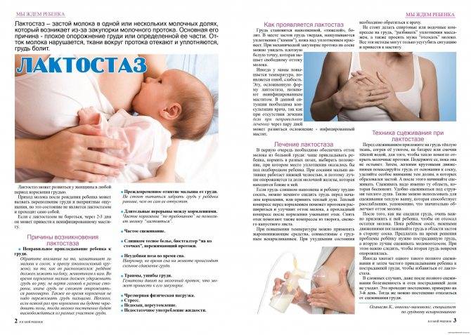 Лактостаз: симптомы, причины, лечение, последствия | москва