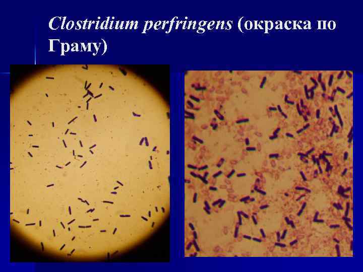 Clostridium difficile у детей – проблемная инфекция