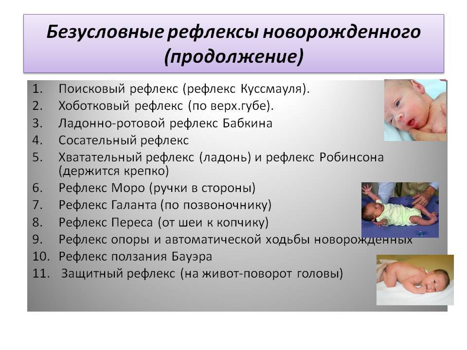 Рефлексы у новорожденных: врожденные, условные, безусловные