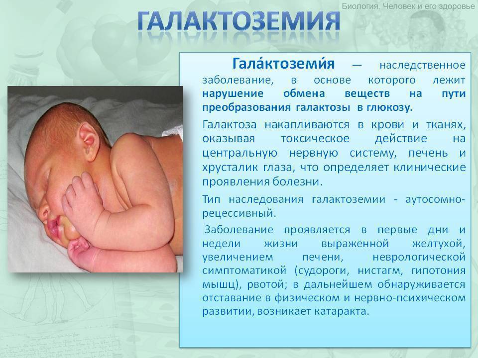 Отделение реанимации и интенсивной терапии новорожденных