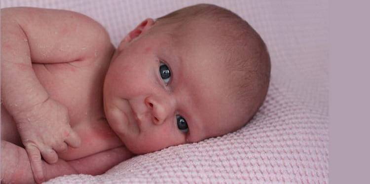 Цианоз у новорожденных причины. цианоз у новорождённых