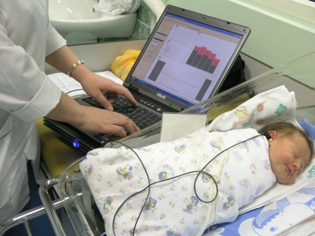 Аудиологический скрининг новорожденных — результаты