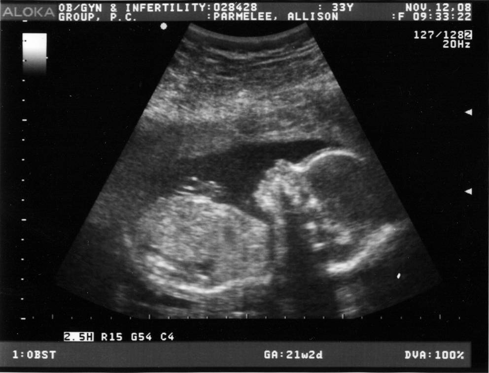 Срок беременности 21 неделя — плод, живот, шевеления, ощущения, узи, анализы