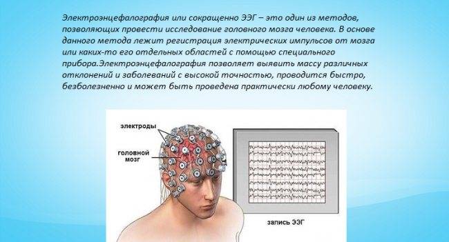 Консультация эпилептолога в москве | цены на консультацию нейропсихологических заболеваний и отклонений у детей в epihelp