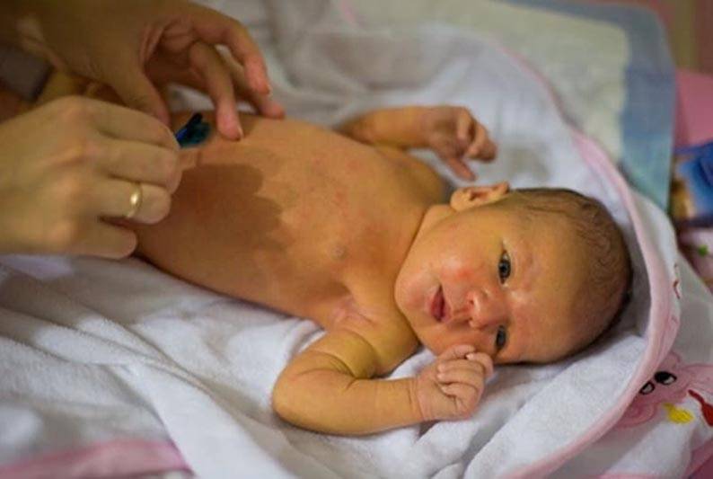Желтуха у новорожденных - причины и последствия, сколько держится, лечение