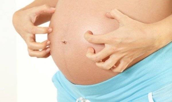 Почему чешется живот во время беременности?