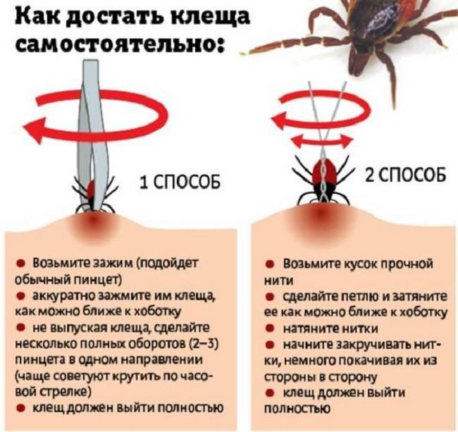 Клещевой системный боррелиоз: что такое болезнь лайма и как ее лечить