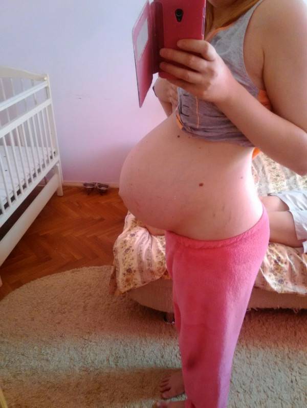36 неделя беременности двойней