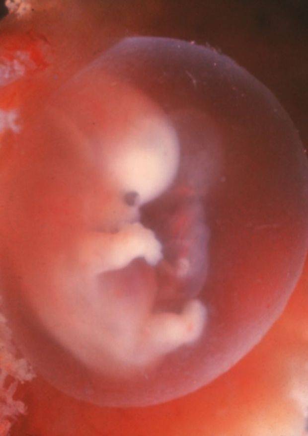 Седьмая неделя беременности: что происходит с малышом, с животом, фото узи – как выглядит ребенок, ощущения